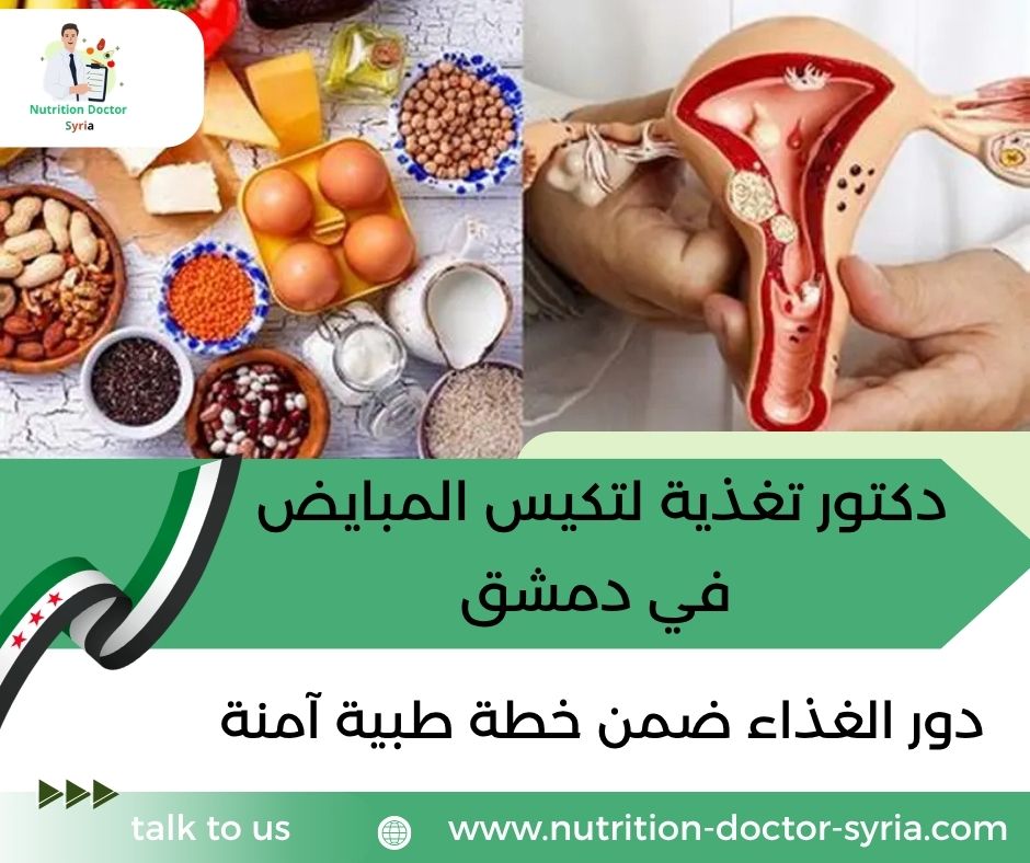 دكتور تغذية لتكيس المبايض في دمشق