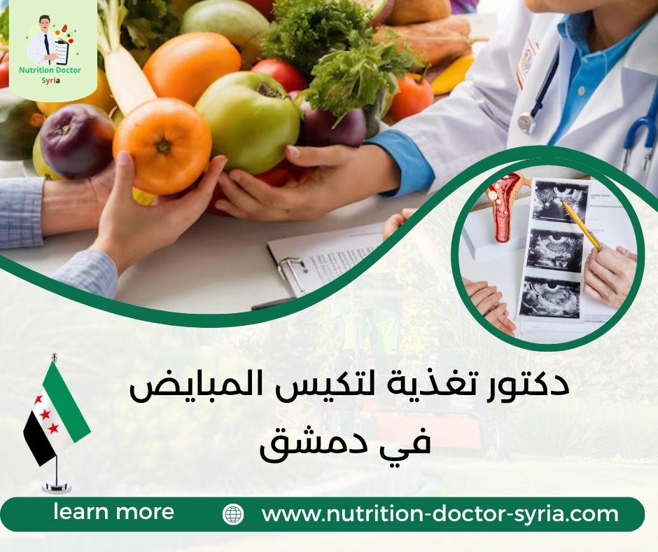 دكتور تغذية لتكيس المبايض في دمشق